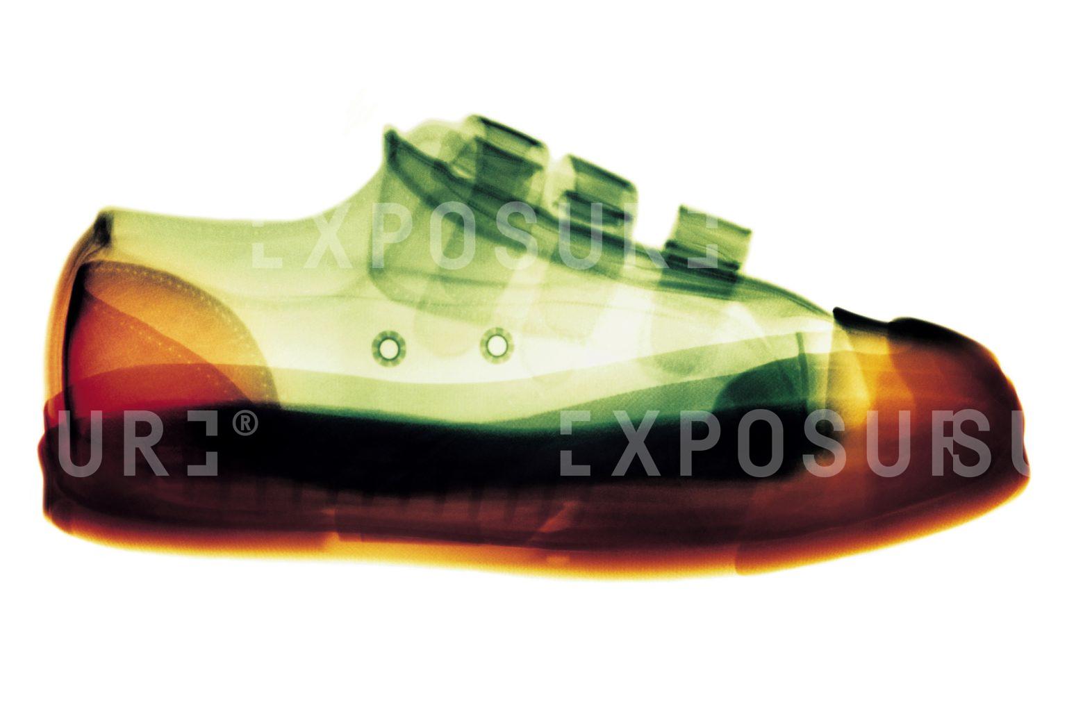 A shoe X-ray